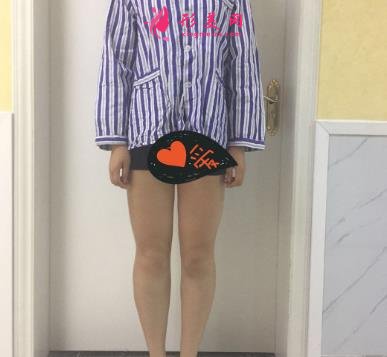 蘭州仁和醫(yī)院抽脂價目表公開公示_手術恢復過程真實圖片分享
