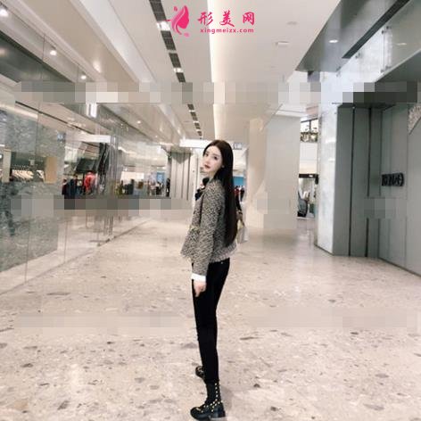 北京純脂吸脂怎么樣？馮慶亮醫(yī)生案例和價格表收費標準顯示中~