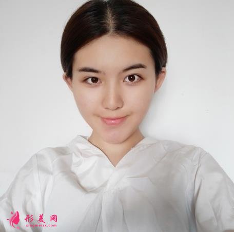 南昌韓美美容醫(yī)院正規(guī)嗎？隆鼻案例照片了解，效果不錯哦！