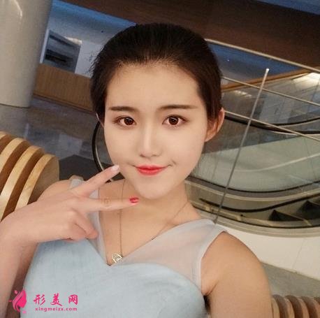 南昌韓美美容醫(yī)院正規(guī)嗎？隆鼻案例照片了解，效果不錯哦！