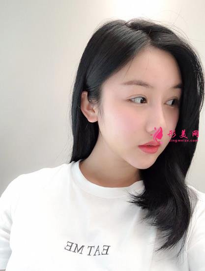 成都排名第一的整容醫(yī)院是誰？對比華西口腔李繼華磨骨案例怎么樣？