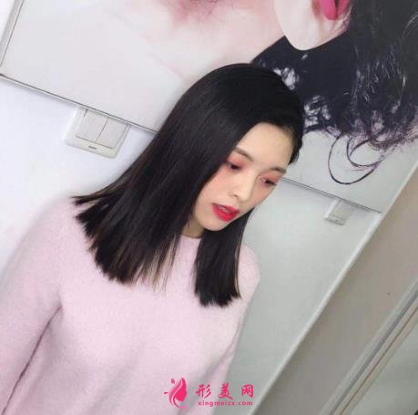 成都顴骨內(nèi)推哪家醫(yī)院好?成都友誼醫(yī)院90天恢復(fù)案例給你參考