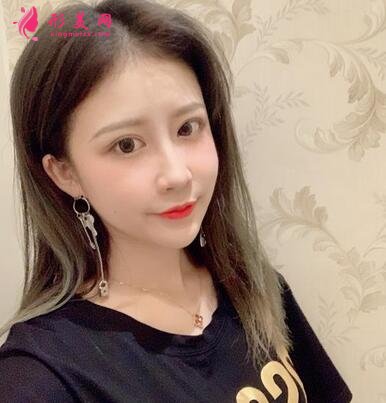 北京協(xié)和醫(yī)院整形科割雙眼皮怎么樣?案例效果和價(jià)格表費(fèi)用分享