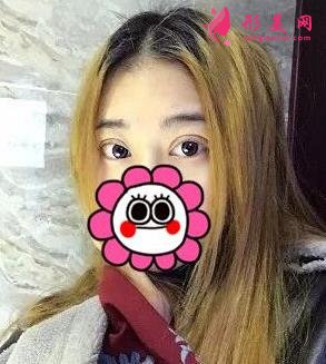 唐山金榮是三甲醫(yī)院嗎?雙眼皮案例及價格表一覽！