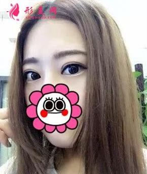 唐山金榮是三甲醫(yī)院嗎?雙眼皮案例及價格表一覽！