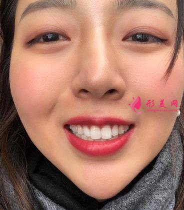 北京友誼醫(yī)院口腔科怎么樣？牙齒矯正案例及價(jià)格表公布啦！