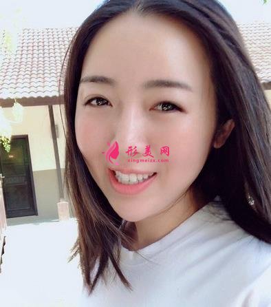 北京友誼醫(yī)院口腔科怎么樣？牙齒矯正案例及價(jià)格表公布啦！