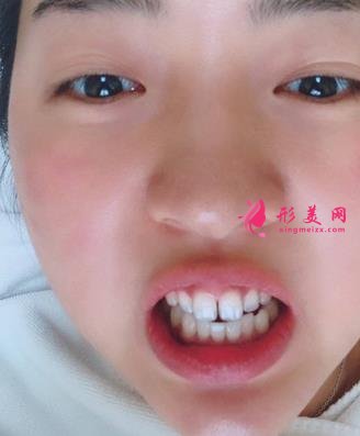 北京友誼醫(yī)院口腔科怎么樣？牙齒矯正案例及價(jià)格表公布啦！