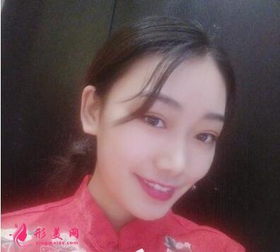 滄州市中心醫(yī)院整形美容割雙眼皮價(jià)格|真實(shí)案例及醫(yī)生名單分享