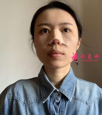 沈陽(yáng)軍區(qū)總醫(yī)院整形科醫(yī)生名單簡(jiǎn)介，附隆鼻案例