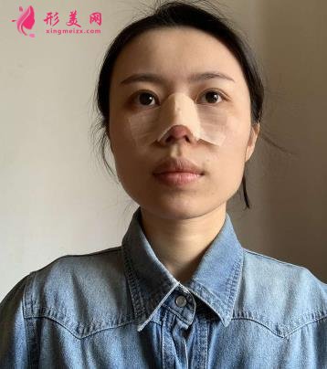 沈陽(yáng)軍區(qū)總醫(yī)院整形科醫(yī)生名單簡(jiǎn)介，附隆鼻案例