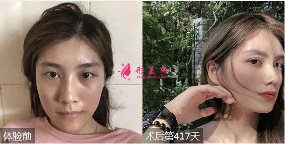 延安人民醫(yī)院整形科價(jià)格表！坐診醫(yī)生及案例一覽