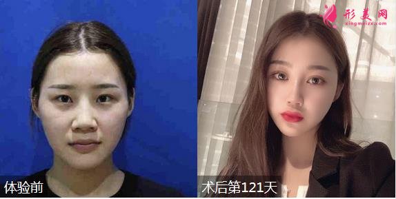 延安人民醫(yī)院整形科價(jià)格表！坐診醫(yī)生及案例一覽