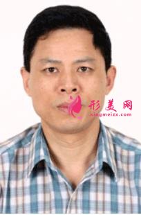 廣東省人民醫(yī)院整形科哪個(gè)醫(yī)生好?價(jià)格表及專家推薦附上