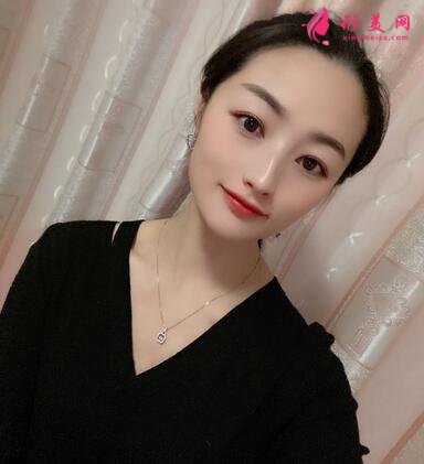邯鄲市第四醫(yī)院整形科價(jià)格表收費(fèi)|雙眼皮案例圖賞析~
