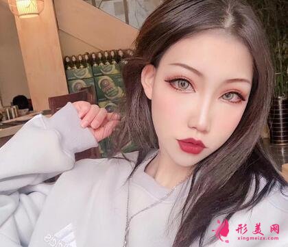 深圳市人民醫(yī)院整形美容科價格表隆鼻整形案例分享