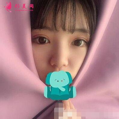 咸陽長城整形美容醫(yī)院怎么樣?價格表|雙眼皮案例分享