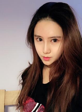 成都美未央鼻綜合手術恢復日記圖