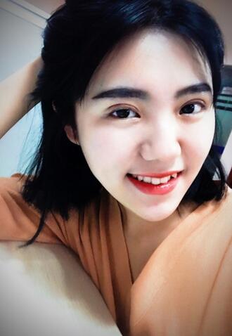 成都美未央雙眼皮恢復過程日記