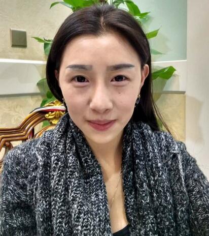 武漢愛美匯自體脂肪填充全臉經(jīng)驗
