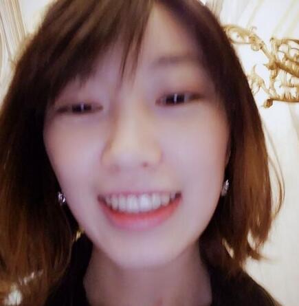 牙齒矯正前后對比圖，成人牙齒矯正費用9800元——成都格林口腔醫(yī)院