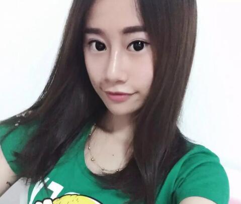 假體隆鼻恢復(fù)后效果圖