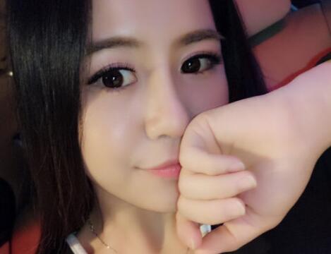 歪鼻子矯正整形恢復過程和對比圖分享——成都魅麗經(jīng)緯醫(yī)療
