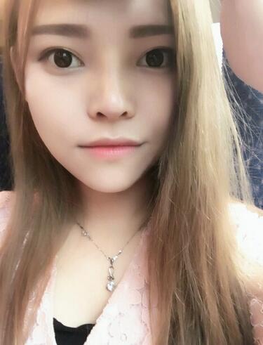 鼻綜合真實恢復期圖片 杭州東方鼻綜合四個月