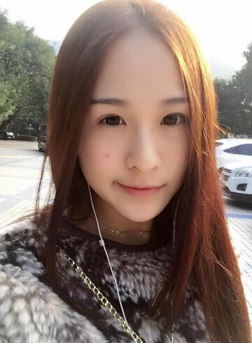 杭州科發(fā)源龍都整形開眼角+割雙眼皮恢復記錄