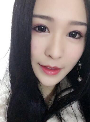 杭州科發(fā)源龍都整形開眼角+割雙眼皮恢復記錄