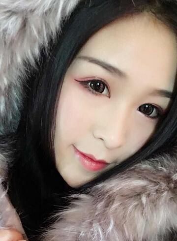 杭州科發(fā)源龍都整形開眼角+割雙眼皮恢復記錄