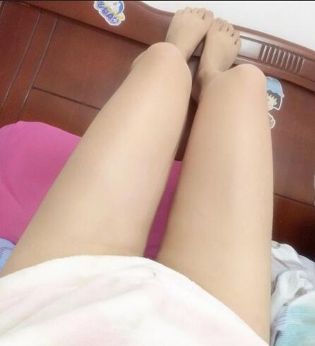 天津繆慈大腿吸脂前后對比圖