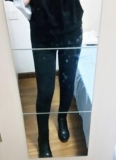 吸脂減肥瘦大腿前后對比圖，光纖溶脂瘦大腿最有效的方法真實案例