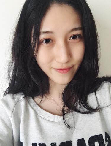 天津繆慈割雙眼皮恢復(fù)圖