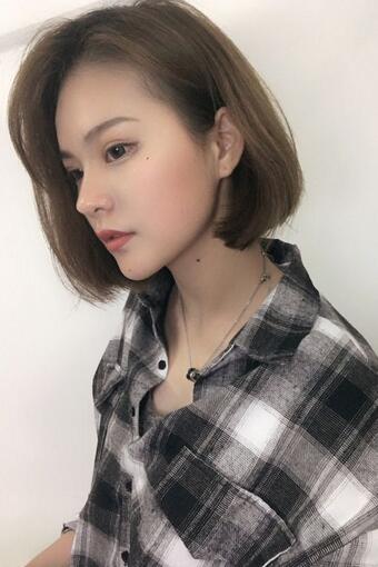 眼綜合術(shù)后1-7天恢復(fù)圖 天津麗姿眼綜合前后對(duì)比