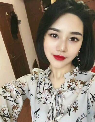 北京醫(yī)院趙紅藝做的雙眼皮+假體隆鼻