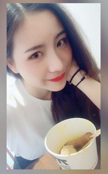 北京藝星王英勇隆鼻案例 鼻綜合三個月