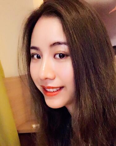 北京藝星王英勇隆鼻案例 鼻綜合三個月