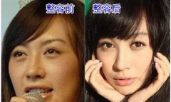 黃曉明前女友有沒(méi)有整形呢 希望以后用作品說(shuō)話